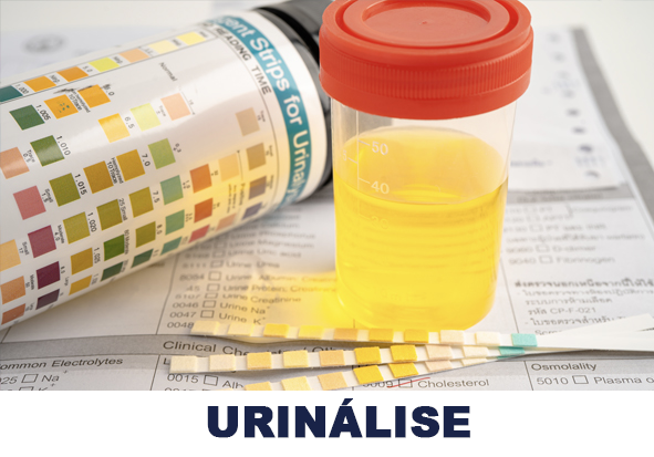 09-URINÁLISE2